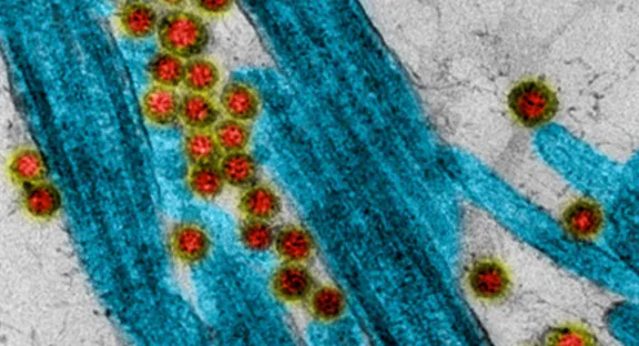 2020, un anno importante per la Fondazione Air Liquide